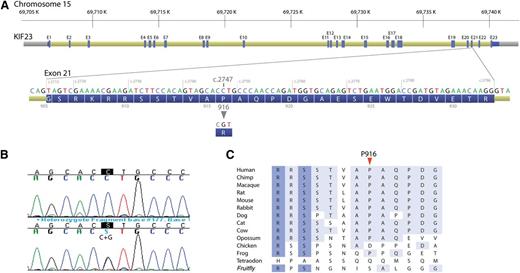 Figure 2. A novel c.2747C>G (p.P916R) mutation in the KIF23 gene. (A) Exon structure of the KIF23 gene with DNA and protein sequence of the exon 21 where the mutation resides. (B) DNA sequence showing c.2747C>G mutation. (Upper) Wild type and (lower) c.2747C>G heterozygous mutations, with mutation position marked in black. (C) Phylogenetic alignment of partial KIF23 protein sequence.