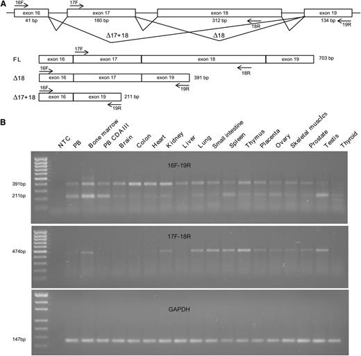 Figure 4. RNA expression of KIF23. (A) Schematic representation of alternative splicing of the exons 17 and 18 of KIF23. The primers used for RT-PCR are indicated by arrows. Two previously reported transcripts (FL and Δ18) as well as a novel one (Δ17+18) are illustrated with the expected sizes of the RT-PCR products. (B) Detection of KIF23 transcripts and a control glyceraldehyde-3-phosphate dehydrogenase (GAPDH) transcript in a broad range of tissues by RT-PCR with primers 16F and 19R (top), 17F and 18R (middle), and GAPDH primers (bottom). Under these conditions, the primers 16F and 19R detected the Δ18 and Δ17+18 transcripts but not the FL transcript, although its expression was observed with the primers 17F and 18R (FL). MassRuler Low Range DNA Ladder (80-1031 bp) and pUC19DNA/MspI (HpaII) Marker, 23 (Thermo Fisher Scientific, Inc., Waltham, MA) were used as a size standard for KIF23 and GAPDH, respectively.