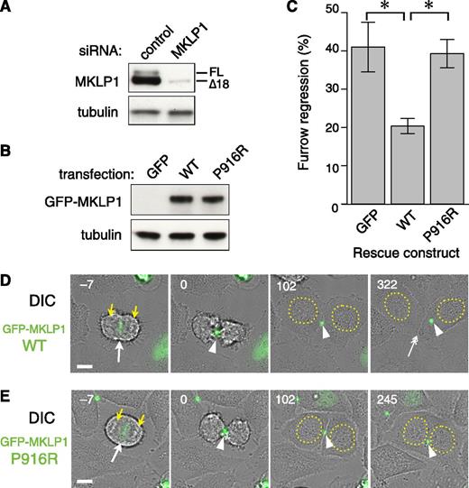 Figure 5. Cytokinesis failure caused by the KIF23 c.2747C>G (MKLP1 p.P916R) mutation. Efficacy of depletion of endogenous MKLP1 (A) and equal expression of wild-type (WT) and P916R GFP-MKLP1 (B) constructs was confirmed by western blotting of the whole cell lysates with anti-MKLP1 (A) or anti-GFP (B) antibody. Tubulin was also blotted as a loading control. (C) Quantitation of cytokinesis failures from live cell recordings of HeLa cells treated with MKLP1 siRNA and transfected with GFP vector or the MKLP1 variants as indicated. The graph shows the percentage of cells that failed cytokinesis averaged from 3 independent experiments in which at least 80 GFP-MKLP1 or GFP-expressing cells were analyzed (supplemental Table 4). *P < .001 after Turkey correction for multiple comparisons. Error bars indicate the standard deviation. (D-E) Stills from the live recordings (A-C) by differential interference contrast (DIC) and GFP fluorescence microscopy. Number indicates the time after midbody formation. GFP-MKLP1 P916R mutant (E) was localized to the spindle midzone (−7 min, arrow) and condensed to form the midbody (0 and 102 min, arrowheads) in a similar manner to the WT GFP-MKLP1 (D). However, the cell membrane of the intercellular bridge was detached from the midbody 217 min after its formation, creating a binucleate cell (245 min). Note that in the WT GFP-MKLP1 cell, abscission happened at 252 min and the 2 daughter cells were separated (D) at 322 min, double arrow. The remnant of the midbody (arrowhead) was incorporated to the cell on the right. Bar, 10 µm. Yellow arrowheads and dotted circles indicate segregating chromosomes and reformed nuclei, respectively.