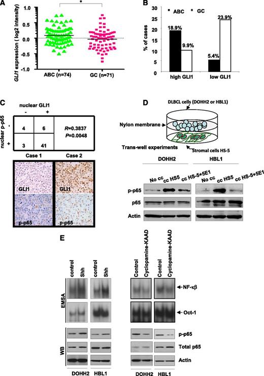 Figure 1. Hh and NF-κB pathways are positively correlated in DLBCL, and Hh pathway contributes to NF-κB activation in DLBCL. (A) GLI1 expression levels in 145 DLBCL tumor biopsies. (B) High GLI1 expression was more frequent in DLBCL of ABC type than in GC type; in addition, low GLI1 expression was more frequent in cases of GC type than in those of ABC type. *P < .05. (C) A significant positive correlation between nuclear GLI1 and nuclear p-p65 (R = 0.3837, P = .0048) in a series of 54 DLBCL analyzed by immunohistochemistry (IHC). Representative IHC staining results for nuclear GLI1 and p-p65 in 2 DLBCL cases. Left (case 1), the tumor cells were negative for GLI1 and p-p65. Right (case 2), the tumor cells expressed both GLI1 and p-p65 in the nuclei. A subset of lymphoma-associated macrophages was also frequently and strongly positive for p-p65, which was confirmed by double immunohistochemical studies using p-p65 and the macrophage marker CD68 (supplemental Figure 1A). (D) Coculture of DLBCL cells (DOHH2 and HBL-1) with the stromal cell HS-5 in trans-well experiments resulted in increased p-p65. This effect was abrogated, at least in part, in the presence of the anti-Hh blocking antibody 5E1 (2.5 µg/mL). (E) DOHH2 and HBL1 cells treated with or without recombinant Shh (250 ng/mL) for 30 minutes or cyclopamine-KAAD (4.8 µM) for 1 hour were subjected to EMSA by using 32P-labeled NF-κB or Oct-1 probes (Upper panel) as well as western blot to detect p-p65 (Lower panel). Dimethylsulfoxide (DMSO; vehicle for cyclopamine-KAAD) and phosphate-buffered saline (for recombinant Shh) were used as controls for drugs treatments.