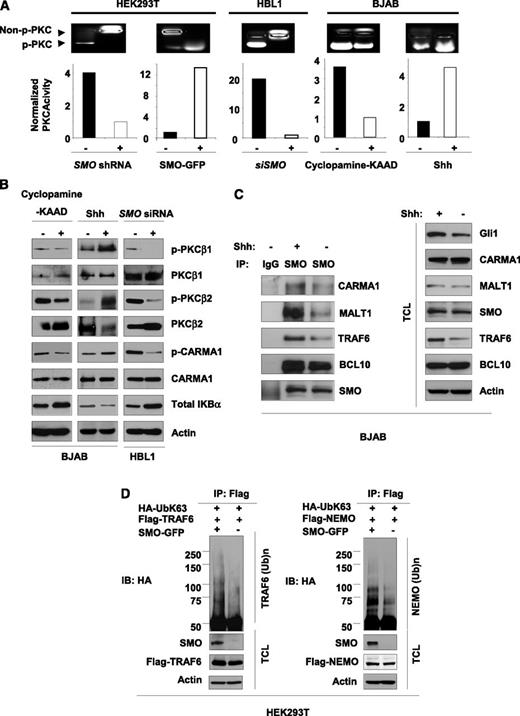 Figure 4. SMO activates NF-κB through PKCβ-CARMA1-MALT1-BCL10-TRAF6-NEMO axis. (A) Stably knocking down SMO or overexpressing SMO showed a decrease or increase in total PKC activity in HEK293T cells, respectively. Inhibition of SMO by cyclopamine-KAAD-KAAD in BJAB or silencing SMO in HBL1 also resulted in decrease of total PKC activity, whereas activating SMO by recombinant Shh in BJAB resulted in increase of total PKC activity. (B) Inhibition of SMO by cyclopamine-KAAD or silencing of SMO in DLBCL cell lines resulted in decrease of p-PKCβ-1 and p-PKCβ-2 and a decrease of p-CARMA1. In contrast, activating SMO by recombinant Shh resulted in increase of p-PKCβ-1 and p-PKCβ-2 followed by increased of p-CARMA1. (C) Activation of SMO with recombinant Shh increased the binding between SMO and CARMAL1/BCL10/MALT1/TRAF6 complex (central lane; +SMO). TCL, total cell lysates. (D) Transient overexpression of SMO resulted in increased TRAF6 and NEMO ubiquitination on K63 lysine indicating stabilization of these proteins and supporting NF-κB activation.