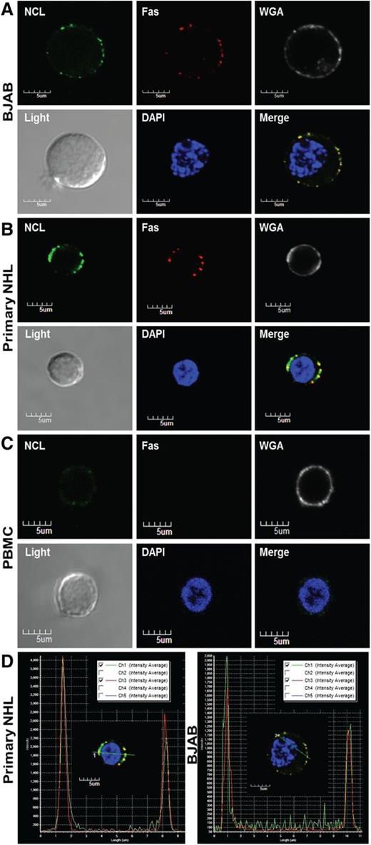 Figure 3. Nucleolin associates with Fas on the surface of primary B-cell lymphoma cells. Localization of nucleolin (NCL)-Fas complexes in B-cell lymphomas. BJAB cells (A) a primary NHL (B) and PBMCs (C) were incubated with an anti-NCL antibody (MS-3), anti-Fas antibody (Abcam), and respective secondary antibodies stepwise at 4°C. Subsequent incubation with wheat germ agglutinin alexa 555 was followed by mounting with prolonged gold anti-fade reagent containing 4,6 diamidino-2-phenylindole (DAPI) and examination by confocal microscopy. The images were captured by the Nikon A1R confocal laser microscope system (Nikon Instruments). All images were acquired at similar voltages for Channel 1 (488 nm) 605-620 V and Channel 3 (647 nm) 510-517 V. An aberration corrected objective (Paplon 1:40) and Nomarski prism for Brightfield DIC image was used for acquiring images. Original image size, 1024 × 1024 with clip size of 302 × 280. PowerPoint was used for further image processing and all panels were adjusted for brightness at correction 44. Top panels (left to right): NCL staining on the surface of BJAB cells (green). Fas staining on the surface of BJAB cells (red). Wheat germ agglutinin revealing surface sialic acid-modified proteins (white) was used as a control for cell membrane localization. Bottom panels (left to right): brightfield image revealing whole cell structure. DAPI nuclear stain (blue). Merged/overlaid images of NCL, Fas, and DAPI; note an almost a complete colocalization of Fas and NCL throughout the surface of BJAB cells (A) and the primary NHL (B) (yellow) and no colocalization on the surface of a healthy lymphocyte, largely because of a lack of surface Fas and low levels of NCL (C). For colocalization staining, we selected a healthy PBMC that had slight positive NCL surface staining as 2 of 15 B-cells scanned by flow cytometry for surface NCL revealed a small shift in staining intensity (MFI) (data not shown) (D) Intensity profile and Pearson’s coefficient analysis for colocalization, revealing positive colocalized staining of Fas and NCL in primary NHL and BJAB cells (merge image from A-B).
