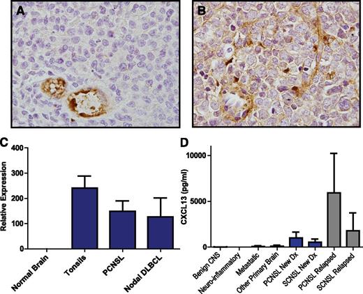 Figure 1. CXCL13 expression in CNS lymphomas. Expression of CXCL13 in a diagnostic specimen of de novo PCNSL (A) and in relapsed SCNSL (B), as demonstrated by immunohistochemistry (×1000). CXCL13 expression is most evident in stromal elements including tumor blood vessels. (C) Quantitative RT-PCR demonstrates markedly increased expression of CXCL13 in diagnostic specimens of PCNSL (N = 23). CXCL13 transcript levels were similar in PCNSL compared with reactive pharyngeal tonsils (N = 2) and nodal DLBCL (N = 9) but barely detectable in specimens of normal brain (N = 3 cases). (D) CXCL13 protein is markedly increased in CSF in association with both PCNSL and SCNSL compared with the vast majority of neuro-inflammatory conditions and other brain tumors. The highest CSF concentration of CXCL13 was detected in association with relapsed CNS non-Hodgkin lymphoma.