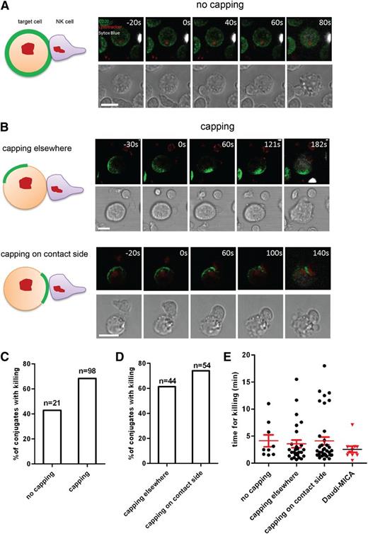 Figure 5. Surface organization of CD20 influences efficiency of target cell killing. Daudi/CD20-GFP cells were preincubated with 10 µg/mL rituximab and then mixed with freshly isolated primary NK cells and imaged for 40 to 60 minutes. (A) A schematic representation (left panel) and 3D reconstructed snapshots from live cell microscopy (right panels) of Daudi cells with unpolarized CD20 interacting with and being killed by an NK cell (CD20 is green, LysoTracker used to visualize lytic granules within NK cells is red, Sytox blue used to visualize dead cells is white). (B) A schematic representation (left) and 3-dimensional reconstructed snapshots from live cell microscopy (right) show examples of target cell killing in the context of CD20 organization when CD20 is capped: cells with CD20 capping away from the site of contact with an NK cell (top panels) and cells with CD20 enriched on the side of the initial contact with an NK cell (bottom panels). Scale bars represent 10 μm. (C) Proportion of conjugates with or without capping of CD20 in which killing of a target cell took place. (D) Proportion of conjugates with capping of CD20 away from the initial contact or at the contact side in which killing of a target cell took place. (E) Time of conjugation between Daudi and NK cell leading to killing of the target was quantified for each category as well as for Daudi-MICA in conjugates with NK cells.