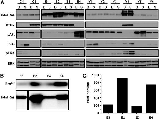 Figure 2. Leukemias initiated by KrasD12/G37 and KrasD12/G64 expression demonstrate distinct signaling profiles. (A) Immunoblot of T-ALL cell lines under basal (B) and starved (S) conditions. Two control T-ALL cell lines with WT Kras (C) from a retroviral insertional mutagenesis screen11 were included. Ten cell lines were generated from independent leukemias induced by either KrasD12/G37 (E1-E4) or KrasD12/G64 (Y1-Y6). (B) Ras was immunoprecipitated from cell lines E1-E4 and then probed with an antibody that recognizes the D12 substitution. (C) quantitative PCR analysis of Kras expression in T-ALL cell lines compared with WT thymus.