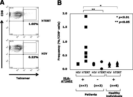 Figure 2. Detection of circulatory hTERT461-469-specific CTL precursors in the periphery of ATL patients. (A) hTERT461-469-specific CTL precursors in PBMCs repetitively stimulated with hTERT461-469 peptide from HLA-A*24:02+ ATL patients were detected by using HLA-A*24:02/hTERT461-469 tetramer. A representative case is shown. HLA-A*24:02/HIV tetramer was used as a negative control. (B) In comparison with HLA-A*24:02− ATL patients (●) (n = 3) and HLA-A*24:02+ healthy individuals (▲) (n = 6), the frequency of hTERT461-469-specific CTL precursors in HLA-A*24:02+ ATL patients (▪) (n = 7) was significantly high (*P < .01; **P < .05). The frequency was 0.88% ± 0.55% for HLA-A*24:02+ ATL patients, 0.11% ± 0.1% for HLA-A*24:02− ATL patients, and 0.2% ± 0.04% for HLA-A*24:02+ healthy individuals (mean ± SD).