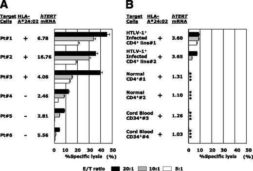 Figure 5. hTERT-siTCR–transduced CD8+ T cells kill freshly isolated ATL cells and newly HTLV-I–infected CD4+ T cells, but not normal cells, in vitro. (A) Freshly isolated HLA-A*24:02+ (n = 3) or HLA-A*24:02− (n = 3) ATL tumor cells overexpressing hTERT mRNA were used as targets in 51Cr-release assays with hTERT-siTCR–transduced CD8+ T cells at the indicated E/T ratios. (B) The same hTERT-siTCR–transduced CD8+ T cells used in panel A at the same E/T ratios were tested in 51Cr-release assays against newly generated HLA-A*24:02+ HTLV-I–infected CD4+ T cells (n = 2) representing HTLV-I carrier CD4+ T cells, original HLA-A*24:02+ normal CD4+ T cells (n = 2) representing the normal counterpart ATL tumor cells (corresponding number indicating cells from the identical donor), and HLA-A*24:02+ normal CB-CD34+ cells (n = 2) encompassing steady-state normal hematopoietic progenitor cells. Listed levels of expression of hTERT mRNA are those relative to the mean levels of expression across 6 PBMC samples from healthy donors determined by qRT-PCR and calculated by using the comparative threshold cycle method. Error bars represent SDs (* indicates less than detectable).