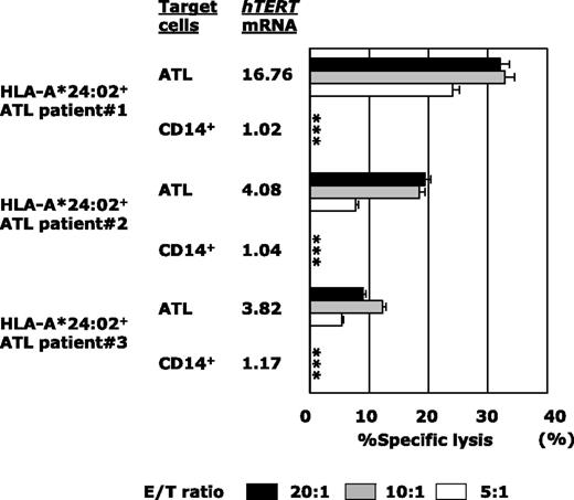 Figure 6. hTERT-siTCR–transduced CD8+ T cells kill freshly isolated autologous ATL tumor cells on the basis of hTERT expression levels. Cytotoxic activity of hTERT-siTCR–transduced CD8+ T cells obtained from HLA-A*24:02+ ATL patients (n = 3) against autologous freshly isolated ATL tumor cells and autologous peripheral CD14+ cells (negative control) was tested in 51Cr-release assays at the indicated E/T ratios. hTERT mRNA in each patient’s ATL tumor cells is listed using a format similar to that used in Figure 5. Error bars represent SDs (* indicates less than detectable).