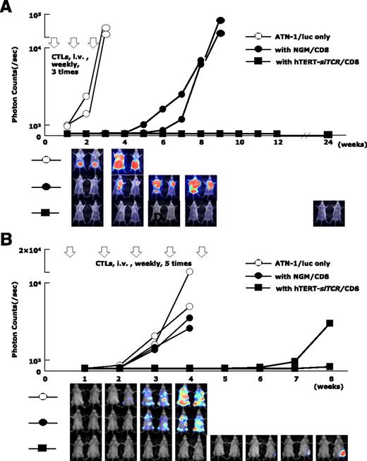 Figure 7. Anti-ATL reactivity of hTERT-siTCR–transduced CD8+ T cells in vivo. (A) Winn assay. NOG mice were coinjected with a luciferase-transduced HLA-A*24:02+ ATL cell line (ATN-1/luc) (5 × 105) and either 2.5 × 106 hTERT-siTCR–transduced (hTERT-siTCR/CD8) or NGM/CD8+ T cells (n = 2 per group). Subsequently, 3 weekly infusions of the respective CD8+ T-cell populations (2.5 × 106 cells per infusion) were administered intravenously (i.v.). Tumor growth was monitored every 7 days by using bioluminescence assay. Nontreated ATN-1/luc cells were similarly inoculated into NOG mice (n = 2) as a control. Although NGM/CD8 activated using OKT-3 and rhIL-2 suppressed tumor growth to some extent, hTERT-siTCR/CD8 durably suppressed tumor growth for longer than 6 months. (B) Therapeutic adaptive transfer model. NOG mice were intravenously inoculated with 5 × 105 ATN-1/luc cells. Four days later, intravenous administration of either 5 × 106 hTERT-siTCR/CD8 or NGM/CD8 (n = 2 per group) was started once a week for a total of 5 infusions. NOG mice given only ATN-1/luc cells (n = 2) were used as a control. In comparison with NGM/CD8, therapeutically infused hTERT-siTCR/CD8 also obviously suppressed the tumor cell growth within the 8-week observation period. Serial images of the bioluminescence assay demonstrate tumor growth in each group.