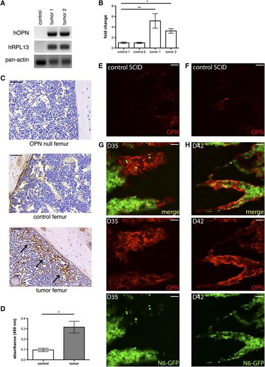Figure 3. The tumor microenvironment contains increased amounts of both tumor and host OPN. (A) RT-PCR shows hOPN mRNA transcripts in tumor-engrafted mice. Human RPL13A and pan-species β actin housekeeping genes serve as loading controls. (B) Quantitative PCR analysis for murine OPN transcripts shows increased levels in Nalm-6 GFP mice, *P = .001, **P = .007. (C) IHC analysis of OPN expression in femurs from an OPN knockout mouse, a control nonengrafted SCID mouse and a SCID mouse with diffuse Nalm-6 GFP leukemic BM infiltration. OPN is detected at the endosteal surface in control mice. In tumor mice, OPN+ leukemic cells are localized near the endosteal niche (arrows). (D) ELISA analysis demonstrates hOPN in BM serum from leukemic mice; control n = 2, tumor n = 6, *P < .0001. (E-F) Intravital confocal microscopic examination of extracellular OPN (red) expression in control SCID mouse calvarial BM. (G-H) Representative images of intravital confocal microscopic study of extracellular OPN expression in the calvarial BM of Nalm-6 GFP (green)–engrafted SCID mice at D35 (G) and D42 (H). Control images E and F correspond to the regions imaged in panel G and H, respectively. These results indicate that extracellular OPN levels are most intense where tumor burden abuts bony margins. Scale bars equal 50 µm.