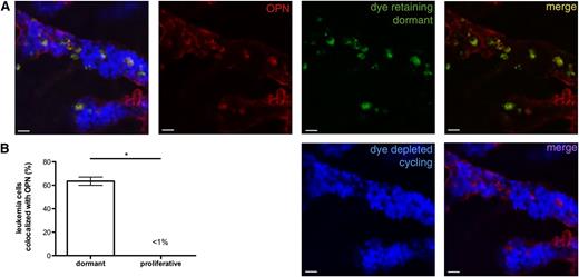 Figure 4. Dormant Nalm-6 GFP localize to areas of high OPN expression. (A) Nalm-6 GFP were labeled with DiR (green), a lipophilic membrane dye that is retained by noncycling cells. At 42 days after engraftment, mice were injected with AF647-labeled isotype control or anti-OPN (red) antibodies to visualize extracellular OPN. The calvarial BM was imaged using intravital confocal microscopic study ∼20 hours after antibody injection. Cycling Nalm-6 GFP cells that have diluted the membrane dye to undetectable levels are represented in blue. (B) Proportion of dye-retaining (dormant) and dye-depleted (cycling) leukemia cells that co-localize with BM extracellular OPN, *P < .0001. Whereas few proliferating Nalm-6 GFP are directly adjacent to extracellular OPN, the majority of dormant Nalm-6 GFP co-localize with the OPN signal, suggesting a functional relationship between stromal OPN and ALL dormancy.