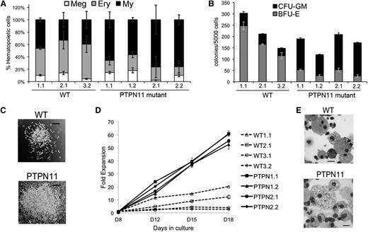 Figure 1. Increased myelopoiesis from PTPN11 p.E76K heterozygous iPSCs. (A) EBs generated from WT or PTPN11 p.E76K (SHP-2) heterozygous iPSCs were cultured in a multilineage cytokine cocktail to support myeloerythroid maturation (see supplemental Methods). The iPSC lines are numbered according to the individual donor followed by the clone from that individual. The relative proportion of myeloid (My; CD45+CD18+), erythroid (Ery; CD235+), and megakaryocytic (Meg; CD41+CD42+) cells produced by each clone in three independent experiments is shown. The PTPN11-mutant clones produced increased proportions of myeloid cells (P = .008) and reduced proportions of erythroid cells (P = .001). (B) Hematopoietic progenitors released from day 8 EBs were enumerated in methylcellulose colony assays. Each bar represents the results of 3 separate experiments, each with triplicate colony assays. Myeloid colonies produced by PTPN11 p.E76K iPSCs were increased (P = .004), and erythroid colonies were decreased (P = .001). (C) Myeloid colonies from methylcellulose assays. Scale bar represents 200 µm. (D) Hematopoietic progenitors from day 8 monolayer differentiation cultures of PTPN11 p.E76K or WT iPSCs were suspended at 25 000 cells/mL in medium containing stem cell factor, GM-CSF, and IL-3 and were quantified at the indicated time points. By day 18, all cells exhibited myeloid morphology, similar to those represented in panel (E). (E) May-Grünwald-Giemsa-stained cells from WT and PTPN11 p.E76K myeloid colonies represented in panels (B) and (C). Scale bars represent 20 µm.