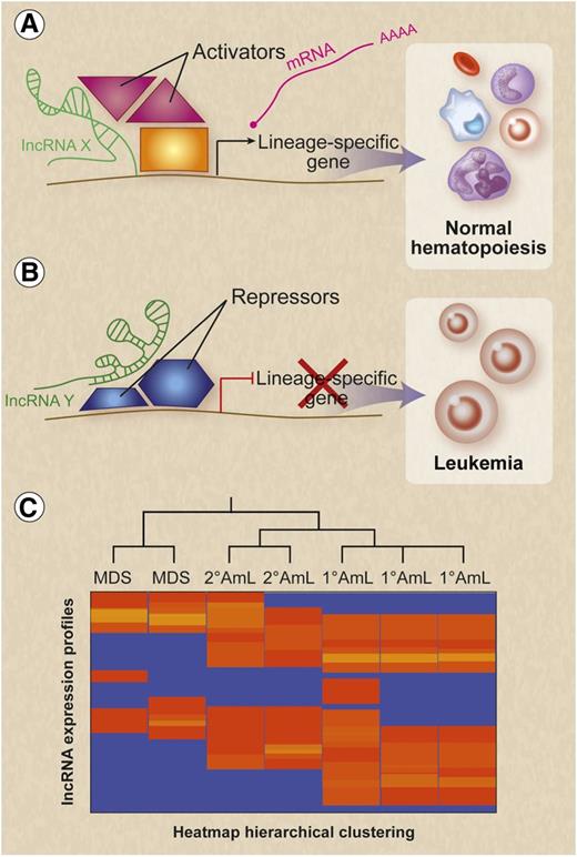 Figure 2. Potential functions for lncRNAs in normal and malignant hematopoiesis. (A) On the basis of their known activities in many cell types (Figure 1), lncRNAs may function during normal hematopoiesis to recruit transcription factors, coactivators, and activating chromatin factors to lineage-specific genes, thereby modulating gene expression to facilitate the differentiation and maturation of blood lineages. LncRNAs are indicated in green. (B) Absence or inappropriate expression of relevant lncRNAs could alter transcription to block normal differentiation and activate leukemic pathways. (C) Hematological malignancy subtypes may express distinct lncRNA expression profiles that reflect cell type of origin, mechanism of transformation, treatment sensitivities, and prognosis. Professional illustration by Debra T. Dartez.