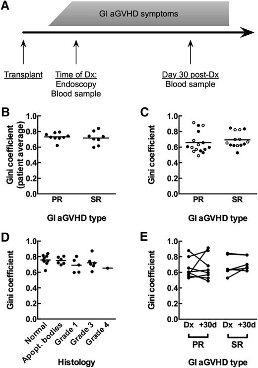 Figure 1. Measurement of T-cell repertoire oligoclonality in human clinical GVHD samples. (A) Diagram of sample collection for patients. (B) GI tissue samples from primary-responsive (PR; n = 8) and steroid-refractory (SR; n = 7) patients show the same - cell repertoire oligoclonality as measured by the Gini coefficient (Mann-Whitney, P = .5893). Comparison is of patient averages of individual tissue samples. (C) Blood samples from PR and SR patients at time of diagnosis (●) and day +30 after diagnosis (○) show the same T-cell repertoire oligoclonality (Mann-Whitney, P = .1919). (D) GI tissue samples do not show increased T-cell repertoire oligoclonality with increased GVHD histology grade. Comparison is of average Gini coefficients per patient at each histology grade (Kruskal-Wallis, P = .2600). (E) No significant change in oligoclonality in the blood between the day of diagnosis and day +30 after diagnosis for either PR or SR patients (Wilcoxon, P = .2188).
