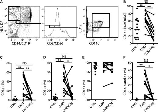 Figure 1. Aberrant expression of CD1 molecules in mDCs in CVID is normalized by IVIg. (A) Representative staining-and-gating strategy. (B) Comparison of the level of CD1c+ mDCs between healthy control participants and patients with CVID, and in these patients before and after IVIg treatment. Comparison of the levels of CD1a expression (C); CD1b expression (D); CD1d expression (E); and CD1a, CD1b, and CD1d triple-expression (F) on CD1c+ mDCs between healthy control participants and patients with CVID, and in these patients before and after IVIg treatment. **P < .01 and *P < .05.