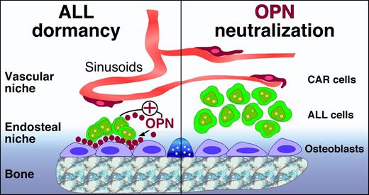 Potential role of OPN in ALL cell dormancy. In the marrow microenvironment, HPCs are maintained in perivascular and endosteal niches, which also can be occupied by ALL and other leukemia cells. In the osteoblast niches, osteoblasts and ALL cells secrete OPN, which becomes part of the extracellular matrix and builds a bridge between ALL cells and osteoblasts/the bone (left). Adherence of ALL cells to OPN via adhesion molecules causes ALL cell dormancy, which makes ALL cells less susceptible to cytotoxic drugs, such as Ara-C. ALL cell dormancy can be reversed by OPN neutralization (right), which causes an increase in dividing/cycling ALL cells. This reversal of ALL cell dormancy by OPN neutralization can potentially be used for “chemosensitization” to target dormant ALL cells that otherwise survive conventional polychemotherapy.