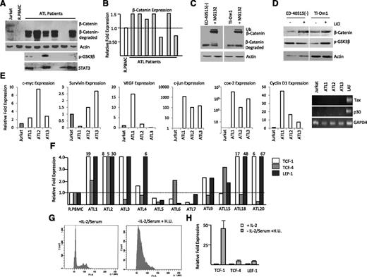 Figure 3. ATL patient samples express high levels of β-catenin cotranscriptional genes, TCF-1 and LEF-1. (A) Western blot analysis of β-catenin, phosphorylated GSK3-β (Ser9), and STAT3 expression from total cellular extracts of 6 ATL patient samples. Extracts were normalized to actin expression. (B) Real-time PCR analysis of β-catenin expression from cDNA from ATL patients. Samples were normalized to GAPDH expression, and the fold change was calculated by comparing values with R.PBMCs’ normalized gene expression. (C) ATL cell lines were treated with MG132 (2.5 µM) or dimethyl sulfoxide control for 8 hours, followed by Western blot analysis on total cellular extract with β-catenin antibody. The upper band corresponds to mono-ubiquitinated β-catenin, the middle band corresponds to wild-type β-catenin, and the lower band corresponds to degraded β-catenin after MG132 treatment. (D) ATL cell lines were treated with 10 mM LiCl for 24 hours. Total cell lysates were normalized to actin expression before Western blot analysis with β-catenin or p-GSK3β (Ser9). (E) Real-time PCR expression of Wnt/β-catenin downstream target genes, c-myc, survivin, VEGF, c-jun, COX-2, and cyclin D1from total cDNA from ATL patients. Fold change was calculated by comparing values with Jurkat-normalized gene expression. The ATL patient cDNAs were additionally analyzed for Tax and p30 expression by qualitative PCR. Jurkat and LAF cDNA were used as negative and positive controls, respectively. (F) Real-time PCR for TCF-1, TCF-4, and LEF-1 from cDNA derived from ATL patients. Real-time PCR was performed in duplicate and samples were normalized to GAPDH expression. Fold change was calculated by comparing values with R.PBMC-normalized gene expression. (G) Cell cycle analysis of 1185 cells treated with or without IL-2, serum, and hydroxyurea after 48 hours. (H) Cells were treated as in (G) and analyzed by real-time PCR analysis. Real-time PCR was performed in duplicate and samples were normalized to GAPDH expression. Fold change was calculated by comparing values with nontreated 1185 cells’ normalized gene expression.