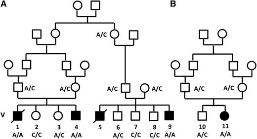 Figure 1. Pedigree of families A and B. Filled symbols denote those affected. The genotype of the c.671 C>A mutation (Thr224Asn) in the VPS45 gene is shown.