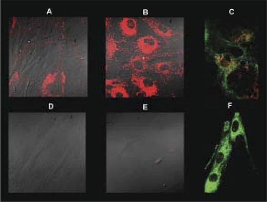 Figure 4. Depletion of lysosomes in fibroblasts. Control (A-C) and patient V-11 (D-F) fibroblasts were grown in regular medium (A,D) or starvation medium (B-C,E-F) and stained with LysoTracker (red) with (C,F) or without (A-B,D-E) subsequent MitoTracker (green) stain. Cells were visualized live by fluorescent confocal microscopy without (C,F) or with differential interference contrast (A-B,D-E) at ×400 magnification.