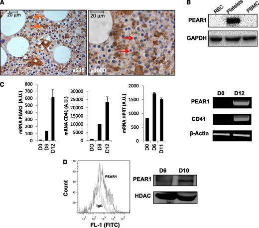Figure 1. PEAR1 expression in differentiating human CD34+ cells. (A) Immunohistochemical staining of PEAR1 in human bone marrow sections, at 630- and 1000-fold magnification; MKs (white asterisk), myeloid precursors (orange arrows), and erythroid precursors (red arrows) are indicated. (B) Western blot for PEAR1 in red blood cell lysates (RBC), platelets, and peripheral blood mononuclear cells (PBMC) vs GAPDH control. (C) PEAR1, ITGA2B (CD41), and hypoxanthine guanine phosphoribosyl transferase expression on day 0, day 6, and day 12 in CD34+ cells by qRT-PCR vs GAPDH control and by RT-PCR vs ACTB (β-actin) control. (D) Flow cytometric measurement of PEAR1 on the membrane in 10-day-old CD34+ cell cultures after staining with immunoglobulin G control (MFI 562) and PEAR1-Ab (MFI 1287), as indicated (representative for n = 3); western blot for PEAR1 in CD34+ cell lysates, at days 6 and 10, with HDAC-1 as loading control. 1 A.U., 1 copy for 105 copies of housekeeping gene.