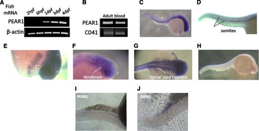 Figure 4. Pear1 expression in the zebrafish. (A) mRNA PEAR1 expression during fish development measured by RT-PCR (dpf, days postfertilization). (B) RT-PCR of Pear1 and CD41 in adult blood in 2 different samples. (C) Whole-mount in situ hybridization (WISH) of Pear1 at 24 hpf with a Pear1 anti-sense probe. (D) Expression in somites. (E) Expression in a putative yolk sac gland. Expression in the nervous system: midbrain-hindbrain boundary (F) and spinal cord neurons (G). (H) Control WISH of Pear1 at 24 hpf with a Pear1 sense probe. Faint Pear1 (I) and clear Gata-1 (J) expression in the caudal region.