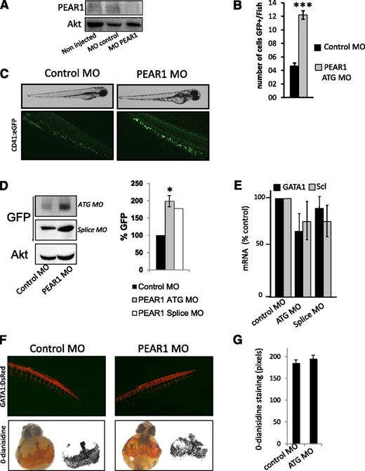 Figure 5. Pear1 in zebrafish is a negative regulator of thrombocyte production. (A) Western blot for PEAR1 (PEAR1-EC Ab) in zebrafish, noninjected, injected with control MO, or PEAR1 ATG MO 3 days postfertilization (dpf); total Akt served as loading control. (B) Analysis of the number of GFP-positive cells in the tail at 2 dpf after PEAR1 MO injection vs control. (C) PEAR1 knockdown and thrombocyte production. Photography of CD41:eGFP fish at 3 dpf after injection with control or PEAR1 ATG MO with white light (top) and with fluorescent light (bottom). (D) Western blot of GFP expression and quantification at 3 dpf in whole fish after injection with control or PEAR1 ATG or PEAR1 splice MO, with Akt as loading control. (E) mRNA expression of Gata-1 and Scl, general markers for erythrocytes and HSCs, by qRT-PCR after treatment with control or PEAR1 MOs. (F) PEAR1 knockdown in erythrocyte production: photography of GATA1:dsred fish at 3 dpf after injection with control or PEAR1 ATG MO with fluorescent light (top); o-dianisidine staining of CD41:eGFP whole fish at 48 hpf and after injection with control or PEAR1 ATG MO (lower). (G) Analysis of area density for stained red blood cells after injection with control or PEAR1 ATG MO.