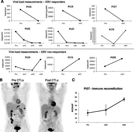 Figure 4. Outcomes after treatment with banked VSTs: EBV-infected patients. (A) Serial viral load measurements before and during 6 weeks post-VST infusion in patients (responders and nonresponders) with EBV-LPD. Results are presented as copies per milliliter. (B, left) Positron emission tomography scan of a patient with extensive and progressive LPD despite sirolimus therapy, with a second scan (right) showing complete resolution of all lesions after VST infusion. (C) Frequency of EBV-directed T cells in peripheral blood before and at weeks 1, 2, and 4 postinfusion, as measured with an IFN-γ ELIspot assay after overnight stimulation of PBMCs with EBV lymphoblastoid cell lines. Results are expressed as mean (±SD) SFC per 2 × 105 input cells.