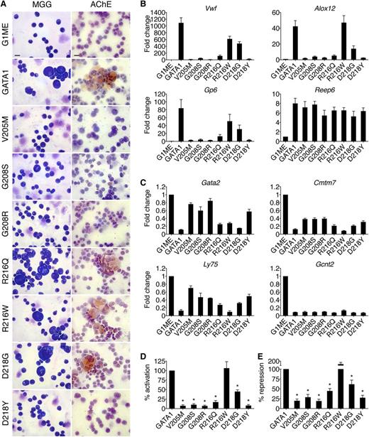 Figure 2. Effects of GATA1 mutations on megakaryocytic maturation. (A) MGG and AChE staining of G1ME cells 72 hours after infection with wild-type or mutant GATA1-expressing vector. Scale bars, 20 μm. (B-C) Expression of (C) GATA1-activated and (D) GATA1-repressed genes in FACS-purified CD42-positive megakaryocytes as determined by RT-qPCR, normalized to β-actin and plotted as fold change from uninfected samples. (D-E) Average transcriptional activities (72 hours following transduction) of all examined activated (D, n = 10) and repressed (E, n = 6) genes. *P < .05. All error bars denote SEM (n = 3) unless otherwise noted. AChE, acetylcholinesterase.