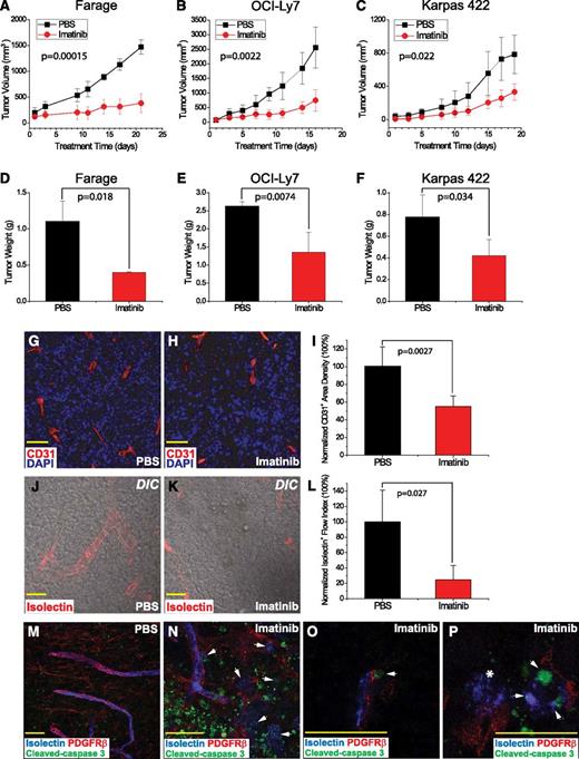 Figure 1. Imatinib impaired growth of human lymphoma xenografts by disruption of tumor-associated microvasculature. (A-C) Tumor growth curves based on tumor volumes (mm3), comparing imatinib mesylate treatment (red) vs PBS control (black). (D-F) Tumor weight (g) at the time of tissue harvest, comparing imatinib (red) vs PBS (black). (G-I) Microvessels delineated by CD31 stain (red) in (G) PBS- and (H) imatinib-treated tumors, and (I) microvessel density normalized to PBS control. (J-L) Confocal DIC capture of functional vascular flow measured by isolectin (red) and normalized to PBS control. (M-P) Confocal analysis of pericyte marker staining in tumors. Blue marks functional vascular flow measured by isolectin, red outlines PDGFRβ+ pericytes, and green shows cleaved caspase 3 in apoptotic cells. (M) PBS-treated tumor. (N) Imatinib-treated tumor, which displays microvascular disintegration and flow leakage (white arrows), and patchy areas of tumor apoptosis/necrosis. (O) White arrows indicate apoptotic, yet structurally intact, PDGFRβ+ cells in close proximity to functional flow. (P) White arrows mark apoptosis of isolectin+ endothelial cells, and white asterisk (*) indicates leakage of infused intravascular isolectin. Scale bar, 50 μm.