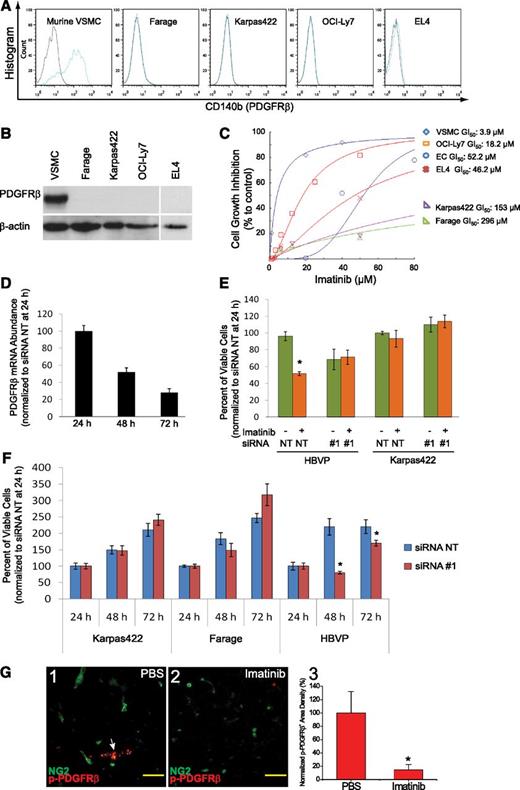 Figure 5. Imatinib inhibited PDGFRβ signaling in vascular mural cells. (A) FACS analysis of PDGFRβ expression in VSMC and lymphoma cells. (B) Immunoblot analysis of PDGFRβ protein expression in stromal and lymphoma cells. (C) Imatinib-mediated growth inhibition in VSMC, endothelial cells, and lymphoma cells. (D) Relative abundance of PDGFRβ mRNA at 24, 48, and 72 hours following transfection of siRNA #1 targeting PDGFRβ in HBVPs, and expressed as the percentage normalized to expression level at 24 hours after transfection. (E) Viable cell counts at 48 hours after treatment with imatinib (20 μM for HBVP, 50 μM for Karpas422), following transfection with siRNA for 24 hours in HBVPs and Karpas422 cells. All cell counts were normalized to values at 24 hours after siRNA transfection. (F) Viable cell counts at 24, 48, and 72 hours after transfection of siRNA nontargeting (NT) or PDGFRβ-directed siRNA #1 in HBVPs, Karpas422, and Farage DLBCL cell lines, and normalized to the values at 24 hours after transfection. Data are representative of triplicate experiments in C-F. (G) Immunostaining for phospho-PDGFRβ in NG2+ pericytes in Karpas422 tumors treated with either (1) PBS or (2) imatinib. White arrow indicates expression of phospho-PDGFRβ in NG2+ pericytes. (3) PDGFRβ signaling was quantified as phospho-PDGFRβ+ area and normalized to PBS control. *P < .05 compared with control. Scale bar, 50 μm.