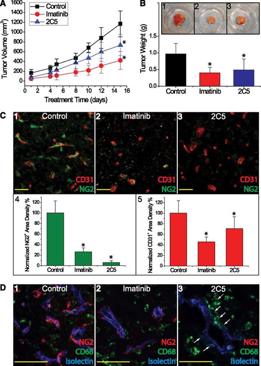 Figure 7. Anti-PDGFRβ antibody 2C5 inhibited growth of Farage xenografts in SCID mice. (A) Tumor growth curves based on tumor volumes (mm3) for PBS or hIgG control (black squares), imatinib (red circles), and 2C5 (blue triangles) treatments. (B) Tumor weight (g) at the time of tissue harvest comparing 2C5 (blue) vs imatinib (red) vs control (black). Inset depicts gross morphology of the resected tumor xenografts treated with (1) control, (2) imatinib, and (3) 2C5. (C) Staining of endothelial cells (CD31, red) and pericytes (NG2, green) in Farage xenografts treated with (1) control, (2) imatinib, and (3) 2C5. (4) NG2+ pericytic density and (5) CD31+ endothelial density were normalized to their respective controls. (D) Confocal analysis of pericytes in Farage tumors treated with (1) control, (2) imatinib, and (3) 2C5. Blue marks functional vascular flow by isolectin staining; red outlines NG2+ pericytes; and green stains CD68+ myelomonocytic cells. White arrows indicate perivascular CD68+ cells in close association with microvessels. *P < .05 compared with control. Scale bar, 50 μm.