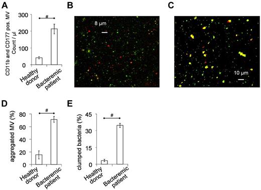 Figure 6. PMN derived MVs in vivo and ex vivo. MVs were separated from serum, using the same conditions as applied for isolated PMNs. (A) Concentration of PMN derived MVs in serum of healthy donors (n = 6) or patients with clinically verified S aureus bacteremia (n = 12), measured by flow cytometry after staining with anti-CD11b and anti-CD177 antibodies. (B-E) MVs separated from serum were incubated with not opsonized S aureus for 30 minutes at 37°C in HBSS with gentle shaking. Interaction was followed by fluorescent microscopy at the end of incubation. (B) Representative image of MVs from healthy donors (of 35 similar images from 4 independent experiments), whereas panel C is representative of MVs from bacteremic patients (53 similar images from 6 independent experiments). Red shows CD11b positivity, green represents S aureus. Statistical analysis (with same criteria as in Figure 5) of microscopic images shows amount of aggregated MVs to all MVs (D), and amount of clumped bacteria to all bacteria (E). Bars show mean ± SEM; #P < .05.