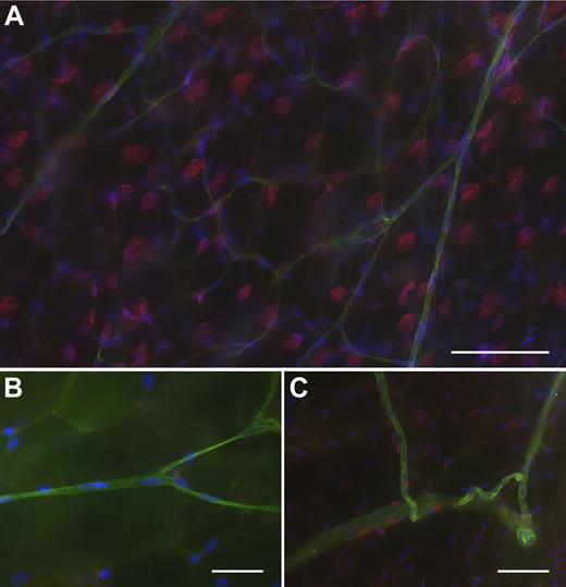 Figure 1. IL-33 is expressed in the mouse mesentery. (A) Representative immunohistochemistry image depicting double-layer mesentery exhibiting strong IL-33 expression (red) in a majority of the cells, (green CD31, blue DAPI nuclear stain). (B) No endothelial cells (green, IB4) expressing IL-33 (red) were found in small or (C) medium-size blood vessels, (blue DAPI nuclear stain). (C) Numerous IL-33–positive cells (red) with elongated nuclei were found attached to medium-size vessels (green, IB4). Scale bars 50 μm.