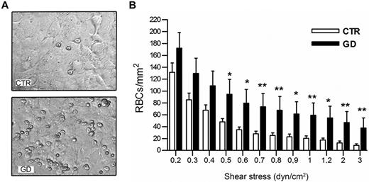 Figure 2. Adhesion of GD and CTR RBCs to HMEC-1 endothelial cells under flow conditions. (A) Typical microscopic images showing that more GD RBCs adhere to HMEC-1 monolayer than healthy volunteer RBCs at 1 dyn/cm2 flow rate. (B) Number of RBCs remaining adherent to HMEC-1 after inflow at 0,2 dyn/cm2 and washout at increasing shear stresses. Blood samples were from 12 healthy CTRs and 15 GD patients. Bars denote SEM (*P < .05; **P < .01; Mann-Whitney test).