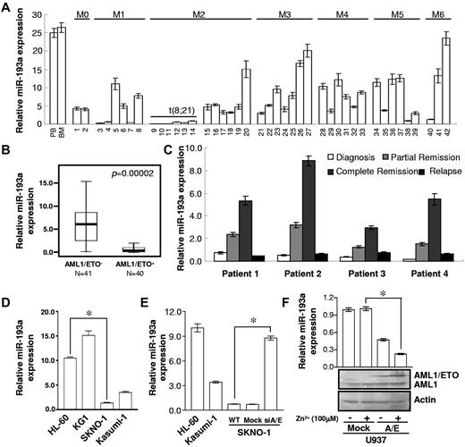 Figure 1. miR-193a levels in leukemia and cell lines. Relative qRT-PCR quantification of miR-193a level in mononucleated cells (MNC) isolated from 42 leukemia patients (A) and 81 AML FAB M2 subtype patients (B). Cases were grouped into 2 categories: those with (AML1/ETO+) and without (AML1/ETO−) t(8;21). AML1/ETO− cases had higher miR-193a expression levels (P = .0005). (C) Serial analyses of miR-193a levels in samples isolated from 4 individual leukemia patients with disease progression. (D) Relative quantification of miR-193a levels in the indicated leukemia cell lines (*P = .0007). (E) Relative quantification of miR-193a levels in HL-60, Kasumi-1, SKNO-1 (WT, mock, and siA/E). The results represent the average of 3 independent evaluations ± SD (*P = .001). (F) Top panel: Relative quantification of miR-193a levels in U937 (Mock and A/E-HA) cells. The results represent the average of 3 independent evaluations ± SD (*P = .006). Bottom panels: Immunoblot analysis for AML1 and AML1/ETO with an anti-AML1 antibody. β-actin was used for protein loading control. Zn2+ treatment (100μM for 16 hours) was used to increase the expression of AML1/ETO in U937 cells.