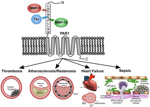 Figure 1. MMP-PAR1 signaling in vascular diseases. PAR1 senses a diverse milieu of extracellular proteases and subsequently relays that information to influence cellular behavior and potentially exacerbate disease pathologies. The N-terminal extracellular domain (exodomain) of PAR1 is cleaved at a canonical site by thrombin and noncanonical sites by MMP-1 and MMP-13. Various signaling outputs can lead to platelet thrombosis, atherosclerosis, in-stent restenosis, heart failure, and sepsis.