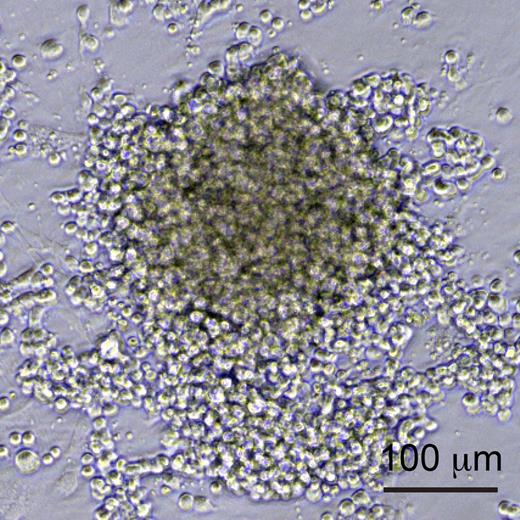 Sox17-overexpressing hemogenic endothelial cells. iPS-derived endothelial cells or pre-HPCs transduced with Sox17 were locked into an adherent, proliferative state, and expressed both endothelial and hematopoietic markers. See Figure 2B in the article by Nakajima-Takagi et al that begins on page 447.