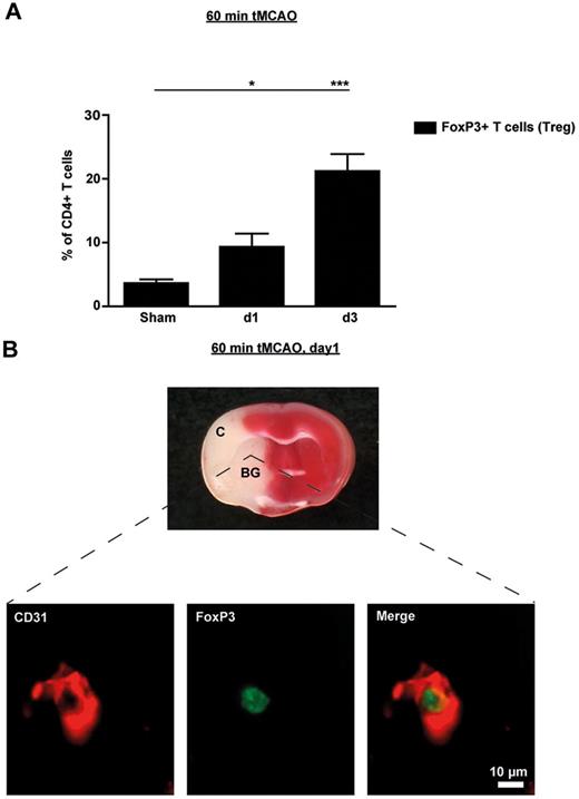 Figure 1. Tregs are present in the ischemic brain early after stroke and are mainly found in the vascular compartment. (A) Flow cytometric analysis of FoxP3+ Tregs counted in the ischemic hemispheres on day 1 (d1) and d3 after 60 minutes of tMCAO or sham-operated mice. Transcardial perfusion of animals was omitted before brain sampling. (B) Top panel is a macroscopic view of a representative TTC-stained brain section from a regular DEREG mouse without diphtheria toxin treatment on day 1 after 60 minutes of tMCAO showing that the immunohistochemical pictures shown at the bottom of the figure were taken from the basal ganglia (BG). Bottom panel is immunohistochemical brain sections from DEREG mice on day 1 after 60 minutes of tMCAO showing FoxP3+ Tregs predominantly in the cerebral vasculature (double staining with the endothelial marker CD31). The area of the basal ganglia is depicted. C indicates cortex. *P < .05; ***P < .0001.