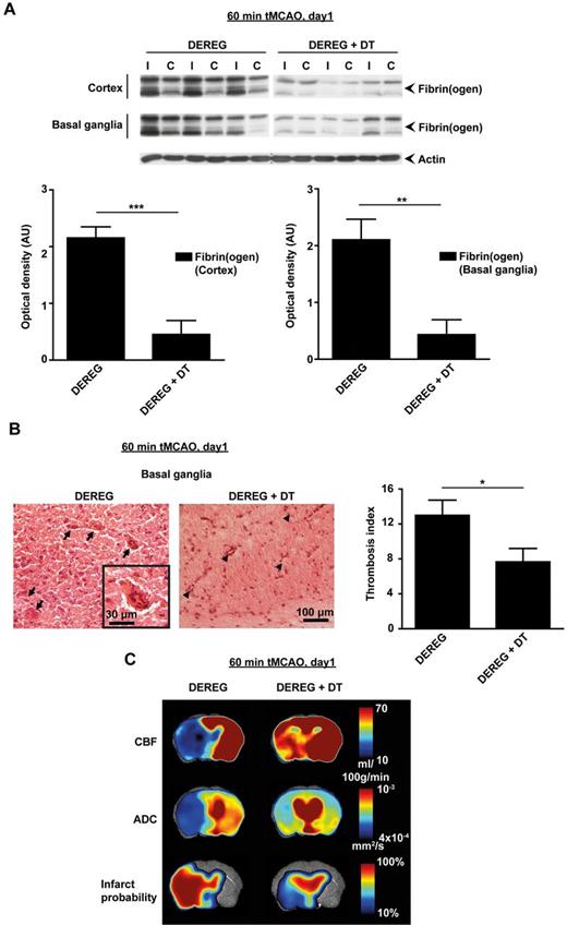 Figure 4. Depletion of Tregs reduces intracerebral thrombosis and improves cerebral blood flow after stroke. (A) Accumulation of fibrin(ogen) in the infarcted (I) and contralateral (C) cortices and basal ganglia of naive DEREG mice and Treg-depleted DEREG mice (DEREG + DT) was analyzed by immunoblotting 23 hours after 60 minutes of tMCAO and quantified. Three representative immunoblots of each group are shown. The higher fibrin(ogen) signal detectable also in the healthy contralateral (= left) hemisphere of nondepleted DEREG mice is probably a consequence of increased thrombotic activity in this region because of massive ipsilateral infarct swelling. DT indicates diphtheria toxin; AU, arbitrary units. (B) The number of thrombotic vessels (thrombosis index) in the ischemic basal ganglia of DEREG mice and Treg-depleted DEREG mice was counted from H&E-stained brain sections on day 1 after 60 minutes of tMCAO. Although numerous occlusions of vessel lumina were found in naive DEREG mice (arrows), the microvascular patency was significantly increased in the absence of Tregs (arrowheads). (C) Reduced intracerebral thrombosis was related to improved CBF, fewer tissue infarctions as reflected by lower apparent diffusion coefficient (ADC) values, and a lower infarct probability in Treg-depleted DEREG mice as revealed by MRI at ultra-high-field strength (17.6 Tesla) on day 1 after 60 minutes of tMCAO. *P < .05, **P < .001, and ***P < .0001 between the indicated groups.