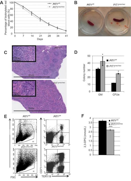 Figure 1. PIT1 deletion results to RBC defects in adult mice. (A) Turnover analysis of RBCs in adult mice constitutively underexpressing PIT1 (PIT1neo/neo). Erythrocytes were biotinylated by tail vein injection and blood was drawn weekly. RBCs of PIT1+/+ (black diamonds) and PIT1neo/neo (white squares) mice were labeled with PE-conjugated streptavidin and analyzed by flow cytometry. Erythrocyte survival was determined by the assessment of the number of biotinylated erythrocytes relative to the starting level (100% biotinylated). (B) Six-week-old PIT1+/+ mice spleen (left) and PIT1neo/neo mice spleen (right). (C) Spleen section stained with H&E at 2.5 and 40× magnification. (D) In vitro differentiation of adult hematopoietic spleen cells. The number of CFU-GM and CFU-E per 105 nucleated spleen cells are indicated. (E) Representative flow cytometric analysis of PIT1+/+ and PIT1neo/neo adult spleen. Percentages of labeled cells were calculated by taking into account the background labeling (baseline defined by omitting Ab). (G) Measurement of 2,3-DPG content of RBCs. Data indicated means ± SEM of at least 3 animals per condition. Significant differences from PIT1+/+ mice (black bar) are indicated. *P < .05; ***P < .001).