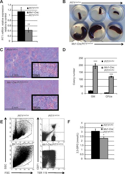 Figure 2. Specific deletion of PIT1 at the adult stage results in hematopoietic defect. (A) Quantitative analysis of PIT1 mRNA expression in Mx1-Cre;PIT1lox/lox BM mice 6 months after pIpC treatment. (B) Six-month-old PIT1lox/lox mice spleen (top) and PIT1neo/neo mice spleen (bottom). (C) Spleen section stained with H&E at 2.5 and 40× magnification. (D) In vitro differentiation of adult hematopoietic spleen cells from Mx1-Cre;PIT1lox/lox. The numbers of CFU-GM and CFU-E per 105 nucleated spleen cells are indicated. (E) Representative flow cytometric analysis of PIT1lox/lox and Mx1-Cre;PIT1lox/lox adult spleen. Percentages of labeled cells were calculated by taking into account the background labeling (baseline define by omitting Ab). (F) Measurement of 2,3-DPG Mx1-Cre-PIT1lox/lox mice blood. Data indicate the means ± SEM of at least 5 animals per condition. Significant differences from PIT1lox/lox mice (black bar) are indicated. *P < .05; **P < .01; ***P < .001.