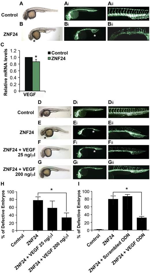 Figure 3. Expression of ZNF24 induces vascular defects in zebrafish embryos. Tg (Fli1:EGFP) embryos were injected with control (A-Aii) or ZNF24 mRNA (B-Bii, and images were taken at 30 hpf. (C) Embryos were injected with control or ZNF24 mRNA, and real-time PCR was performed using primers specific for VEGF and ELF1α. *P = .03. (D-Gii) Effects of ZNF24 expression can be rescued by overexpression of VEGF. Tg (Fli1:EGFP) embryos were injected with control (D-Dii), ZNF24 mRNA (E-Eii), ZNF24 mRNA and VEGF mRNA 25 ng/μL (F-Fii), or ZNF24 mRNA and VEGF mRNA 200 ng/μL (G-Gii), and images were taken at 30 hpf. Black asterisk indicates pericardial edema; white asterisk, abnormal caudal vascular plexus. (H) Percentages of defective embryos injected with indicated reagents. *P = .004 comparing embryos injected with ZNF24 mRNA alone and embryos injected with ZNF24 mRNA and VEGF mRNA 200 ng/μL. N indicates the number of experimental repeats; n the total number of embryos injected. Control: N = 3, n = 119; ZNF24: N = 3, n = 140; ZNF24 + VEGF 25 ng/μL: N = 3, n = 80; ZNF24 + VEGF 200 ng/μL: N = 3, n = 164. (I) Percentages of defective embryos injected with indicated reagents. *P = 8.09E-04 comparing embryos injected with ZNF24 mRNA alone and embryos injected with ZNF24 mRNA and VEGF promoter ODN. N indicates the number of experimental repeats; n the total number of embryos injected. Control: N = 3, n = 295; ZNF24: N = 3, n = 158; ZNF24 + Scrambled ODN: N = 3, n = 178; ZNF24 + VEGF ODN: N = 3, n = 147. Brightfield images were obtained at room temperature using a Nikon Eclipse 80i microscope equipped with a 4×/0.13 objective (Nikon), SPOT 7.4 Slider camera and SPOT software (Version 4.6, Diagnostic Instruments). Fluorescent images were obtained at room temperature using a Nicon Eclipse 80i microscope equipped with 4×/0.13 and 10×/0.30 objectives (Nikon), Retiga-2000R camera (QImaging), and NIS-Elements AR 3.0 software (Nikon).