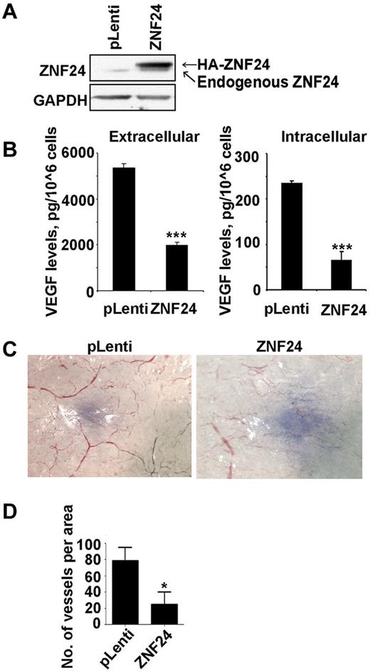 Figure 4. Overexpression of ZNF24 in human breast cancer cells leads to decreased VEGF levels and inhibition of tumor angiogenesis. (A) Protein extracts of control MDA-MB-231 cells and cells overexpressing ZNF24 were analyzed by immunoblot. (B) ELISA assays were performed using conditioned medium (left) and cell extracts (right) from control MDA-MB-231 cells or cells overexpressing ZNF24. ***P < .001. (C) In vivo angiogenesis assays were performed by injecting control MDA-MB-231 cells or cells overexpressing ZNF24. Images of tumor nodules were taken 3 days after injection. (D) Numbers of vessels induced by tumor nodules were quantified. pLenti: n = 23 tumor nodules; ZNF24: n = 17 tumor nodules. Data represent means ± SEM. *P < .05. Images were obtained at room temperature using a Leica MZ16F stereomicroscope equipped with a 4× objective with full-open aperature (Meyer Instruments), Retiga EXi camera (QImaging), and Openlab modular imaging software (PerkinElmer).