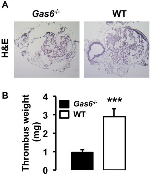 Figure 1. Inactivation of Gas6 protect mice against venous thrombosis. (A) FeCl3-induced thrombosis in the IVC of WT and Gas6−/− mice. Representative hematoxylin and eosin staining of thrombi shows that WT mice develop larger thrombi than Gas6−/− mice (original magnification ×4). (B) Quantification of thrombus weight demonstrated that thrombi from Gas6−/− mice weigh significantly less than thrombi from WT mice (n = 7). ***P < .001.