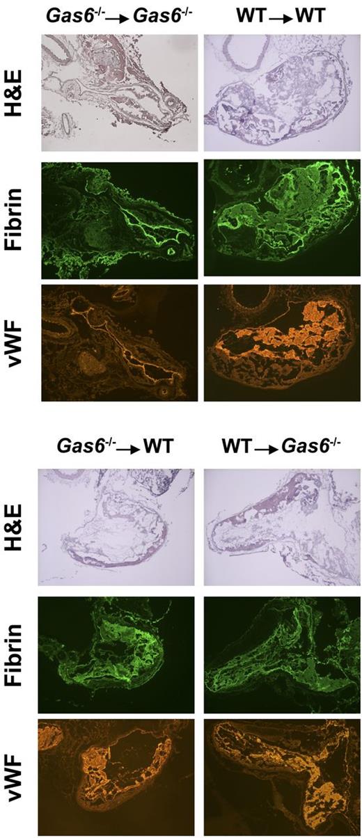Figure 4. Hematoxylin and eosin staining and immunofluorescence analysis demonstrated that thrombi from chimeric mice had intermediate amounts of fibrin and VWF compared with Gas6−/− → Gas6−/− and WT → WT. Original magnification ×4.