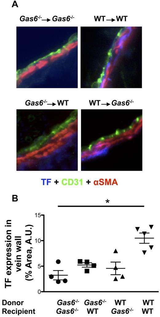 Figure 5. FeCl3-induced thrombosis increased expression of TF in WT but not in Gas6−/− mice. (A) Representative immunofluorescence staining for TF in the IVC of the 4 groups of mice generated by the platelet depletion/reconstitution experiments (original magnification ×40). Endothelial cells were stained using CD31-AlexaFluor 488-nm antibodies (green). Smooth muscle cells were stained with α-smooth muscle actin (αSMA) antibody coupled with Cy3 dye (red). TF was stained with a specific primary antibody followed by AlexaFluor 405-nm (blue). (B) Quantifications of TF expression were done in the vascular wall, delimited by the endothelial cells and the smooth muscle cells. TF expression was decreased in the vascular wall of the Gas6−/− → Gas6−/− group compared with the WT → WT. Interestingly, expression of TF was intermediate in the 2 chimeric groups but not statistically different from the Gas6−/− → Gas6−/− or WT → WT groups (n = 4 or 5 per group). *P < .05.