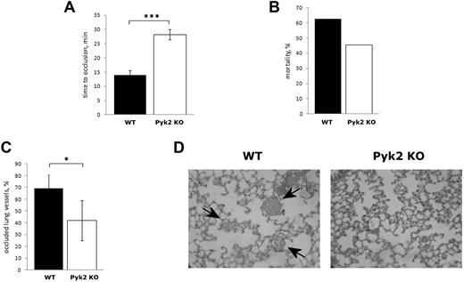 Figure 2. Analysis of thrombus formation in Pyk2-KO mice. (A) Photochemical-induced arterial thrombosis assesses as time required for occlusion of femoral artery measured by laser Doppler in WT (black bars) and Pyk2-KO (white bars) mice. Data are the means ± SD of measurements performed on 5 animals for both genotypes. ***P < .001. (B) Pulmonary thromboembolism–associated mortality caused by injection of epinephrine plus collagen in WT (black bars, 10 animals analyzed), and Pyk2-KO (white bars, 11 animals analyzed) mice. (C) Percentage of vessels occluded by platelet thrombi in the lungs of WT (black bars) and Pyk2-KO (white bars) mice on injection of collagen and epinephrine as determined by count in 10 microscopic fields for each lung section. Data are reported as the means ± SD. *P < .05. (D) Representative histology images (100×) of lungs from WT and Pyk2-KO mice after collagen plus epinephrine injection. Staining is with H&E. Arrows indicate the platelet-rich thrombi.