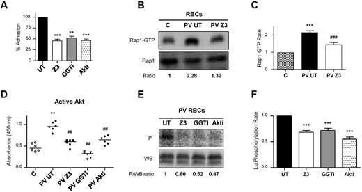 Figure 6. The JAK2V617F/Rap1/Akt pathway is involved in increased PV RBC adhesion to laminin. All results shown in this figure were obtained with blood samples from the same 6 patients with PV. (A) Effect of JAK2, Rap1, or Akt inhibitors (Z3, GGTI, or Akti, respectively) on RBC adhesion to laminin at 2 dyn/cm2, determined with blood samples obtained from 6 patients with PV. Paired t test, **P < .01 and ***P < .001, compared with untreated RBCs (UT). (B) Quantification of Rap1-GTP in a control “C” and a PV patient blood samples, in the absence (PV UT) or presence (PV Z3) of Z3. The top and bottom panels show the amounts of Rap1-GTP and total Rap1, respectively. The GTP-bound fraction is determined by the Rap1-GTP/Rap1 ratio, with the ratio of the C column being the reference value. (C) Quantification of Rap1-GTP in blood samples from 6 controls “C” and 6 PV patients, in the absence (PV UT) or presence (PV Z3) of Z3, paired t test, ***P < .001 compared with C, ###P < .001 compared with PV UT (n = 6). (D) Quantification of Akt activity in the same control “C” and PV blood samples in the absence (UT) or presence of Z3, GGTI, or Akti. Horizontal bars indicate medians; Mann-Whitney test, **P < .01, compared with C, ##P < .01 compared with PV UT. (E) Quantification of Lu phosphorylation in a blood sample of a PV patient, in the absence (UT) or presence of Z3, GGTI, or Akti. The phosphorylated fraction is determined by the P/WB ratio, with the ratio of the UT column being the reference value. (F) Quantification of Lu/BCAM phosphorylation in blood samples from the 6 PV patients, in the absence (UT) or presence of the same inhibitors, paired t test, ***P < .001 compared with UT.