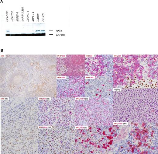 Figure 1. SPIB protein expression in selected human cell lines and normal hematolymphoid populations. (A) Western blot in selected human cell lines revealed overexpression of SPIB (clone 235 D/C7) in the Burkitt lymphoma and ABC-DLBCL cell lines DAUDI and OCILY-3, respectively. None of the other cell lines studied, including the GC-type DLBCL, T-cell lymphoma, or monocytic leukemia cell lines, showed positivity with SPIB mAb. (B) SPIB immunohistochemical expression in reactive lymph node hyperplasia. SPIB mAb stained the nuclei of mature B cells and plasmacytoid dendritic cells. The SPIB protein was expressed at low levels in mantle zone B cells and up-regulated in the GC reaction. In the GC, it stains centroblasts and centrocytes (see coexpression with BCL6 and GCET1); however, late centrocytes that enter the plasma cell differentiation program do not express SPIB (see double immunostains with Blimp1 and CD38). Normal plasmacytoid dendritic cells express SPIB intensely (see double immunostains with CD123). The intensity of the staining in this specific subpopulation was higher than that in the mature B-cell compartment. No expression was found in other subpopulations of the myelomonocytic cell lineage (ie, macrophages, follicular dendritic cells, and reticular and interdigitating cells).