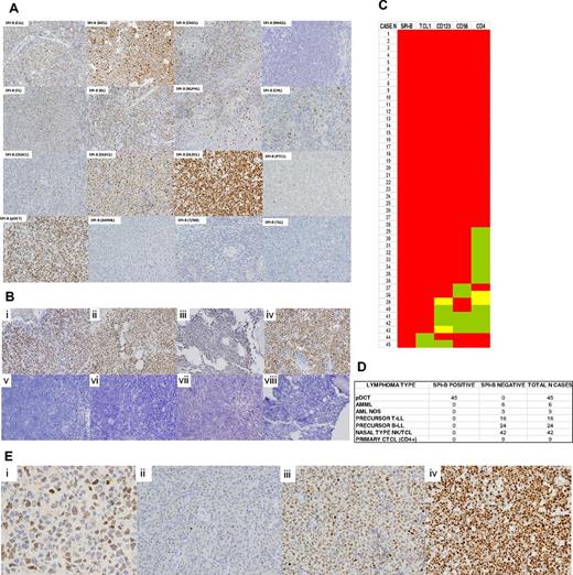 Figure 2. SPIB protein expression in major hematolymphoid neoplasms and human BPDCs. (A) The SPIB protein is overexpressed in BPDC neoplasms and is expressed with variable intensity among B- and T-cell lymphoma types. Cases of BPDC neoplasms show clear-cut nuclear expression of the SPIB protein. However, other cutaneous infiltrates that can mimic this specific tumor type lack SPIB protein expression (a case of acute myelomonocytic leukemia, AMML, is shown for comparison). (B) SPIB is overexpressed in BPDC neoplasms irrespective of the localization of the infiltrate. Cutaneous (i-ii), BM (iii), and lymph node (iv) infiltrates show a similar intensity and distribution of the expression in the neoplastic population. SPIB was found to be negative in all 24 cases of B-cell acute lymphoblastic leukemia tested (v-viii). (C) Heat map showing the distribution of immunohistochemical expression of conventional markers used in the diagnosis of 45 cases of BPDC neoplasms. As depicted, BPDC neoplasms showed significant phenotypic diversity: 29 of 45 (64%) expressed all 4 markers (ie, TCL1, CD123, CD4, and CD56), 11 of 45 (24%) lacked 1 marker (8 cases CD4, 2 cases CD56, 1 case TCL1), 3 of 45 (6%) lacked 2 markers, and 2 of 45 (4%) lacked 3 markers. SPIB continued to be overexpressed in all cases of BPDC neoplasms. Red indicates cases with intense homogeneous expression, yellow indicates cases with partial expression, and green indicates cases that were negative for a given marker. (D) SPIB is overexpressed in all BPDC neoplasms but is negative in all of the tumor types studied (including acute myelomonocytic leukemia, acute myeloid leukemia not otherwise specified, precursor T- and B-lymphoblastic lymphoma/leukemia, nasal type natural killer/T-cell neoplasms, and primary cutaneous T-cell CD4+ lymphoma). (E) SPIB immunohistochemical expression scoring. (i) SPIB mAb positively stains the nuclei of the normal GC B cells. The intensity of these GC B cells is used as the threshold for scoring the neoplastic cases. (ii) DLBCL case with weakly positive SPIB expression. (iii) DLBCL case with moderate intensity SPIB expression. (iv) DLBCL with intense expression of SPIB protein.